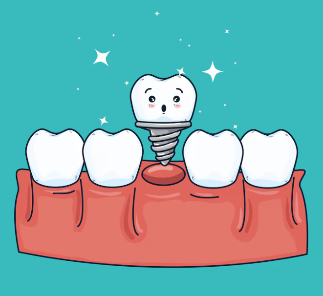 高雄植牙手術流程｜從評估到恢復完整步驟說明